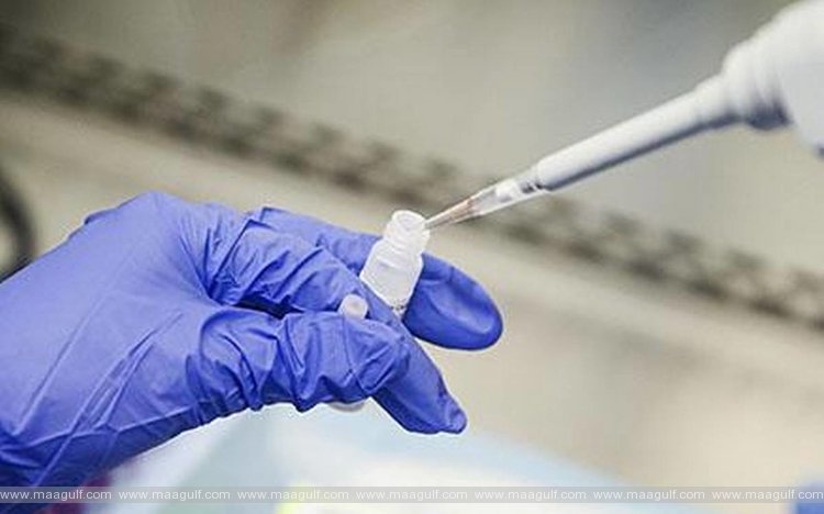 ఏపీలో కరోనా కేసుల వివరాలు